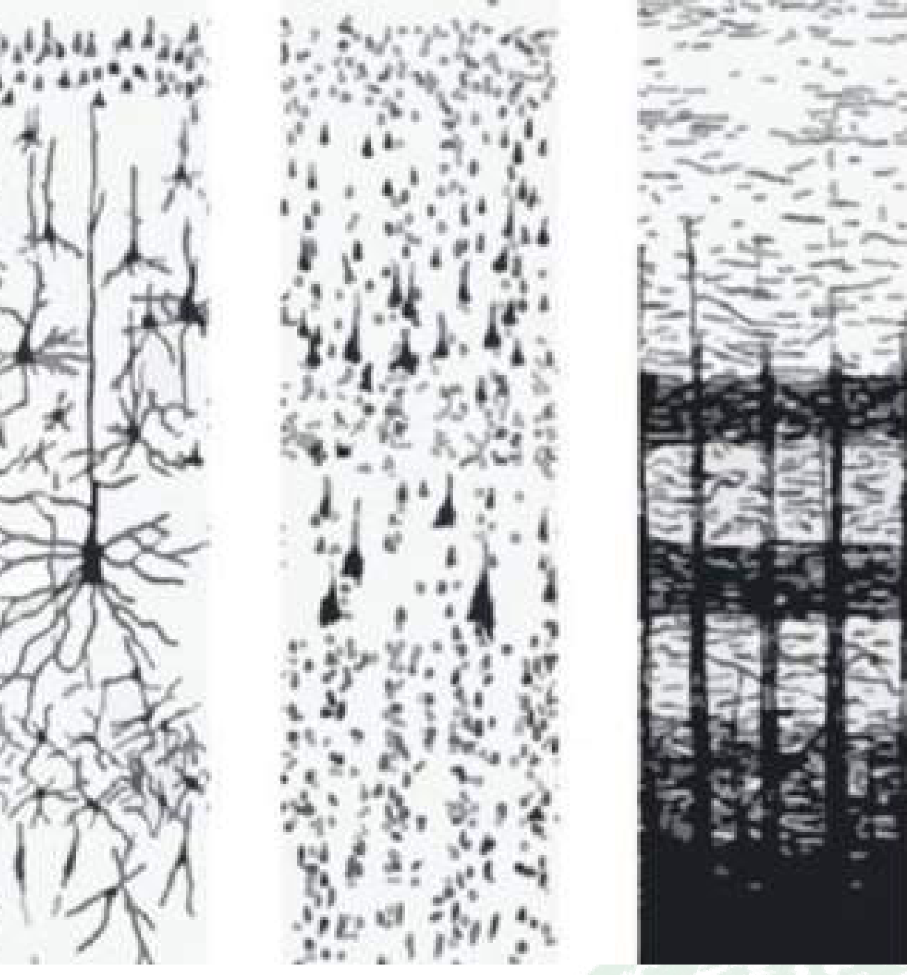 Comparative cortical histology showing Golgi, Nissl, and Weigert stains highlighting neuronal morphology, cell bodies, and myelinated fibers.
