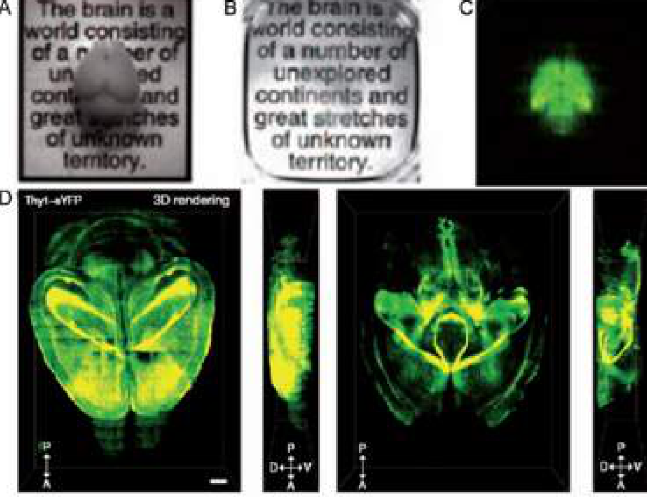 CLARITY tissue-clearing process showing an intact mouse brain before and after lipid removal with subsequent 3D fluorescence reconstruction.