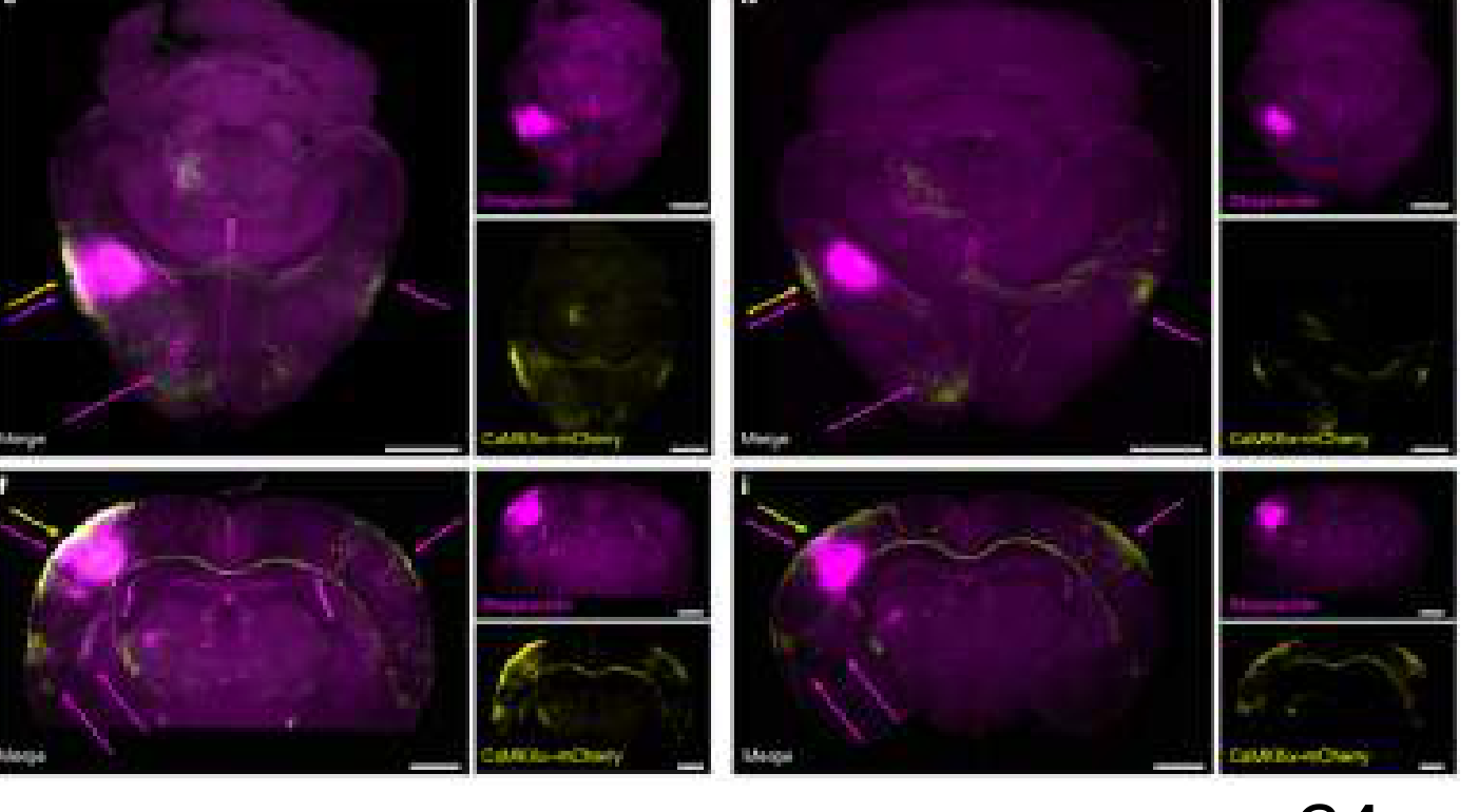 Horizontal and coronal virtual sections showing changes to astrocytic (magenta) and neuronal (yellow) networks after unilateral whisker trimming.